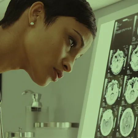 doctor looking at brain scans in lab